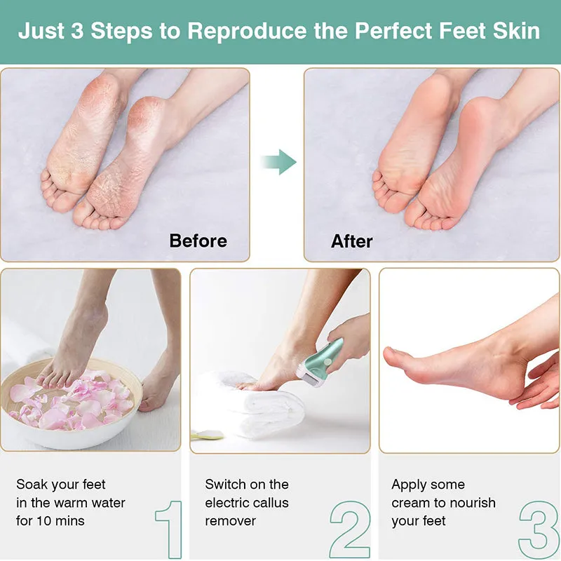 USB Rechargeable Electric Foot File Callus Remover Foot Grinder